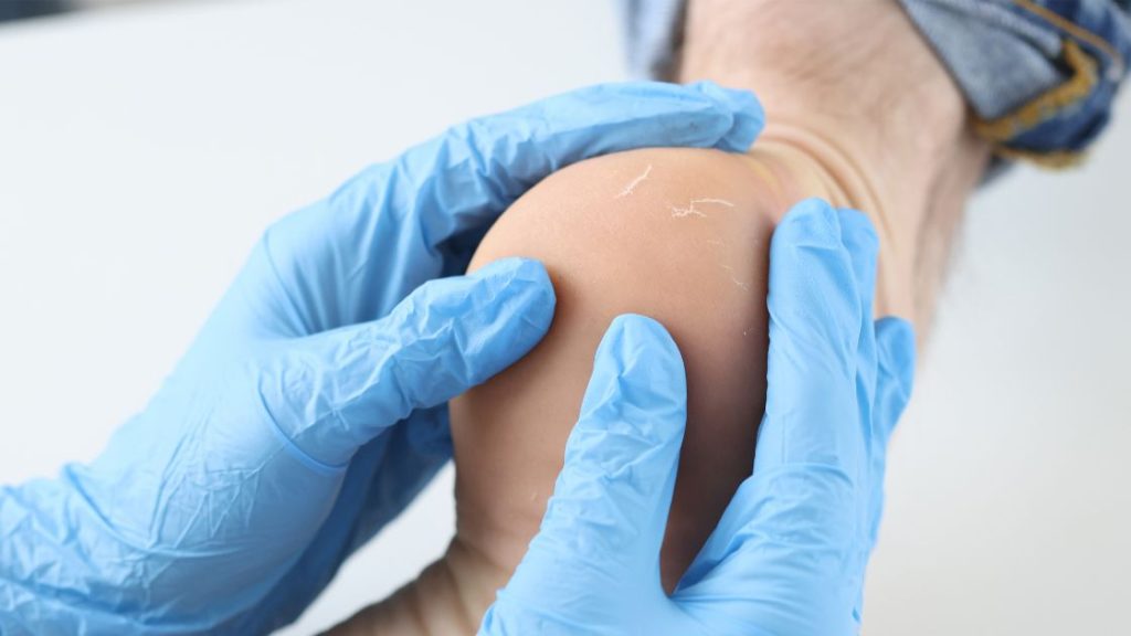 Plantar Fasciitis Examination